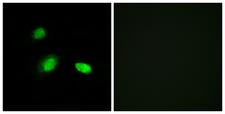 HSPB2 / HSP27 Antibody - Immunofluorescence analysis of A549 cells, using HSPB2 Antibody. The picture on the right is blocked with the synthesized peptide.