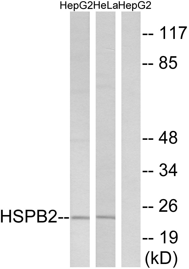 HSPB2 / HSP27 Antibody - Western blot analysis of lysates from HepG2 and HeLa cells, using HSPB2 Antibody. The lane on the right is blocked with the synthesized peptide.
