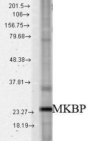 HSPB2 / HSP27 Antibody - Western blot analysis of MKBP in a rat tissue mix using a 1:1000 dilution of HSPB2 / HSP27 antibody.  This image was taken for the unconjugated form of this product. Other forms have not been tested.