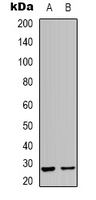 HSPB2 / HSP27 Antibody - Western blot analysis of HSPB2 expression in HeLa (A); human heart (B) whole cell lysates.