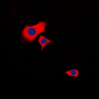 HSPB2 / HSP27 Antibody - Immunofluorescent analysis of HSPB2 staining in HeLa cells. Formalin-fixed cells were permeabilized with 0.1% Triton X-100 in TBS for 5-10 minutes and blocked with 3% BSA-PBS for 30 minutes at room temperature. Cells were probed with the primary antibody in 3% BSA-PBS and incubated overnight at 4 deg C in a humidified chamber. Cells were washed with PBST and incubated with a DyLight 594-conjugated secondary antibody (red) in PBS at room temperature in the dark. DAPI was used to stain the cell nuclei (blue).