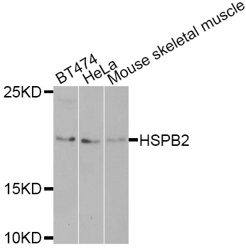 HSPB2 / HSP27 Antibody - Western blot analysis of extracts of various cell lines.