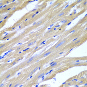 HSPB2 / HSP27 Antibody - Immunohistochemistry of paraffin-embedded mouse heart.