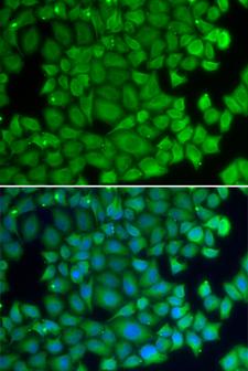 HSPB2 / HSP27 Antibody - Immunofluorescence analysis of U20S cells.