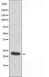 HSPB2 / HSP27 Antibody - Western blot analysis of extracts of HepG2 cells using HSPB2 antibody.