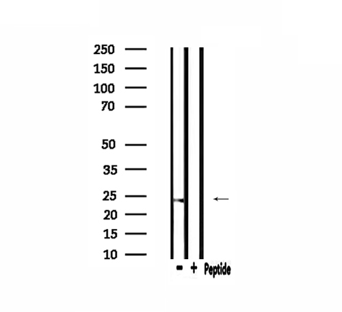 HSPB2 / HSP27 Antibody - Western blot analysis of extracts of rat brain tissue using HSPB2 antibody.