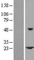 HSPB2 / HSP27 Protein - Western validation with an anti-DDK antibody * L: Control HEK293 lysate R: Over-expression lysate