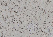 HSPB3 Antibody - 1:100 staining rat kidney tissue by IHC-P. The sample was formaldehyde fixed and a heat mediated antigen retrieval step in citrate buffer was performed. The sample was then blocked and incubated with the antibody for 1.5 hours at 22°C. An HRP conjugated goat anti-rabbit antibody was used as the secondary.