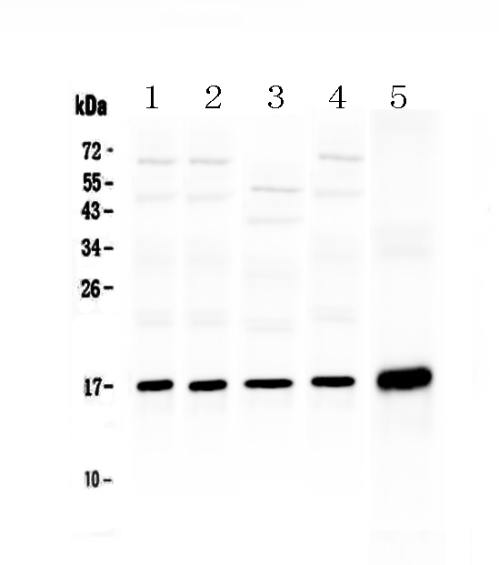 HSPB6 / HSP20 Antibody - Western blot analysis of Hsp20 using anti-Hsp20 antibody. Electrophoresis was performed on a 5-20% SDS-PAGE gel at 70V (Stacking gel) / 90V (Resolving gel) for 2-3 hours. The sample well of each lane was loaded with 50ug of sample under reducing conditions. Lane 1: rat cardiac muscle tissue lysate,Lane 2: rat skeletal muscle tissue lysate,Lane 3: rat testis tissue lysate,Lane 4: mouse testis tissue lysate,Lane 5: human A431 whole Cell lysate. After Electrophoresis, proteins were transferred to a Nitrocellulose membrane at 150mA for 50-90 minutes. Blocked the membrane with 5% Non-fat Milk/ TBS for 1.5 hour at RT. The membrane was incubated with rabbit anti-Hsp20 antigen affinity purified polyclonal antibody at 0.5 µg/mL overnight at 4°C, then washed with TBS-0.1% Tween 3 times with 5 minutes each and probed with a goat anti-rabbit IgG-HRP secondary antibody at a dilution of 1:10000 for 1.5 hour at RT. The signal is developed using an Enhanced Chemiluminescent detection (ECL) kit with Tanon 5200 system. A specific band was detected for Hsp20 at approximately 17KD. The expected band size for Hsp20 is at 17KD.