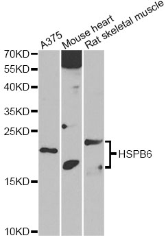 HSPB6 / HSP20 Antibody - Western blot analysis of extracts of various cell lines, using HSPB6 antibody at 1:1000 dilution. The secondary antibody used was an HRP Goat Anti-Rabbit IgG (H+L) at 1:10000 dilution. Lysates were loaded 25ug per lane and 3% nonfat dry milk in TBST was used for blocking. An ECL Kit was used for detection and the exposure time was 90s.