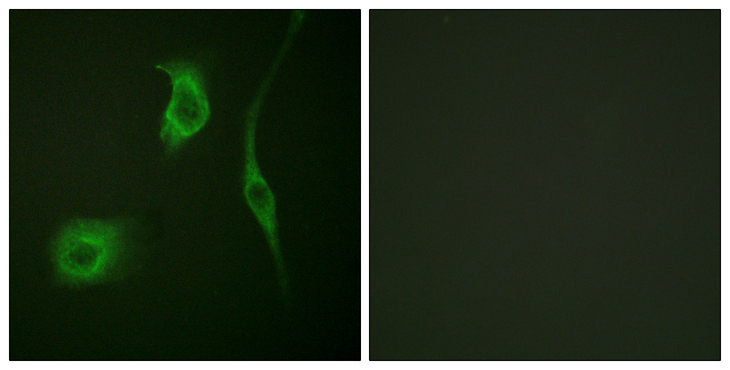 HSPB6 / HSP20 Antibody - Immunofluorescence analysis of HeLa cells, using HSP20 (Phospho-Ser16) Antibody. The picture on the right is blocked with the phospho peptide.