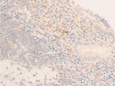 HSPB6 / HSP20 Antibody - 1:100 staining human appendix tissue by IHC-P. The tissue was formaldehyde fixed and a heat mediated antigen retrieval step in citrate buffer was performed. The tissue was then blocked and incubated with the antibody for 1.5 hours at 22°C. An HRP conjugated goat anti-rabbit antibody was used as the secondary.