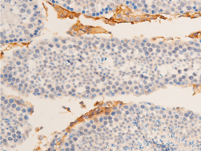 HSPB6 / HSP20 Antibody - 1:100 staining mouse testis tissue by IHC-P. The tissue was formaldehyde fixed and a heat mediated antigen retrieval step in citrate buffer was performed. The tissue was then blocked and incubated with the antibody for 1.5 hours at 22°C. An HRP conjugated goat anti-rabbit antibody was used as the secondary.