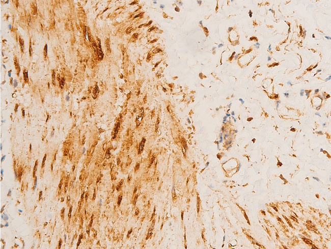 HSPB6 / HSP20 Antibody - 1:100 staining human gastric tissue by IHC-P. The tissue was formaldehyde fixed and a heat mediated antigen retrieval step in citrate buffer was performed. The tissue was then blocked and incubated with the antibody for 1.5 hours at 22°C. An HRP conjugated goat anti-rabbit antibody was used as the secondary.