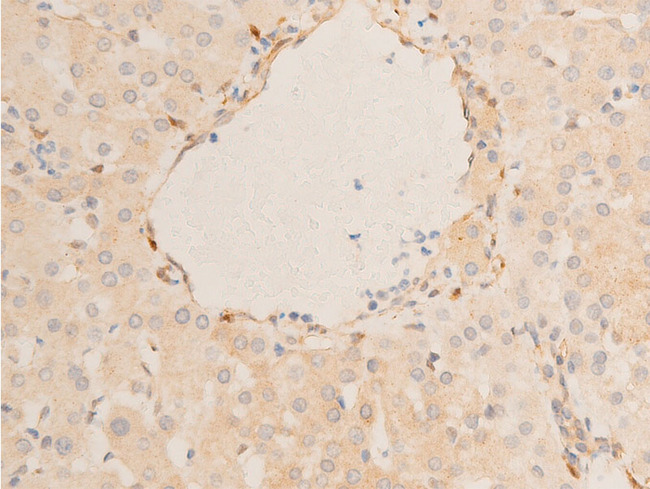 HSPB6 / HSP20 Antibody - 1:100 staining human liver tissue by IHC-P. The tissue was formaldehyde fixed and a heat mediated antigen retrieval step in citrate buffer was performed. The tissue was then blocked and incubated with the antibody for 1.5 hours at 22°C. An HRP conjugated goat anti-rabbit antibody was used as the secondary.