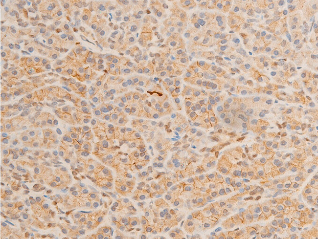HSPB6 / HSP20 Antibody - 1:100 staining human pancreas tissue by IHC-P. The tissue was formaldehyde fixed and a heat mediated antigen retrieval step in citrate buffer was performed. The tissue was then blocked and incubated with the antibody for 1.5 hours at 22°C. An HRP conjugated goat anti-rabbit antibody was used as the secondary.