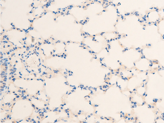 HSPB6 / HSP20 Antibody - 1:100 staining mouse lung tissue by IHC-P. The tissue was formaldehyde fixed and a heat mediated antigen retrieval step in citrate buffer was performed. The tissue was then blocked and incubated with the antibody for 1.5 hours at 22°C. An HRP conjugated goat anti-rabbit antibody was used as the secondary.