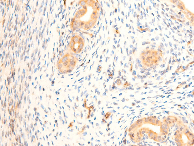 HSPB6 / HSP20 Antibody - 1:100 staining rat uterine tissue by IHC-P. The tissue was formaldehyde fixed and a heat mediated antigen retrieval step in citrate buffer was performed. The tissue was then blocked and incubated with the antibody for 1.5 hours at 22°C. An HRP conjugated goat anti-rabbit antibody was used as the secondary.