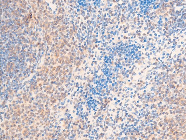 HSPB6 / HSP20 Antibody - 1:100 staining rat spleen tissue by IHC-P. The tissue was formaldehyde fixed and a heat mediated antigen retrieval step in citrate buffer was performed. The tissue was then blocked and incubated with the antibody for 1.5 hours at 22°C. An HRP conjugated goat anti-rabbit antibody was used as the secondary.