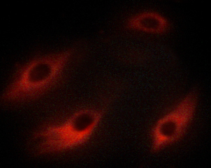 HSPB6 / HSP20 Antibody - Staining HeLa cells by IF/ICC. The samples were fixed with PFA and permeabilized in 0.1% saponin prior to blocking in 10% serum for 45 min at 37°C. The primary antibody was diluted 1/400 and incubated with the sample for 1 hour at 37°C. A Alexa Fluor® 594 conjugated goat polyclonal to rabbit IgG (H+L), diluted 1/600 was used as secondary antibody.
