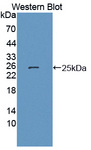 HSPB7 / CvHSP Antibody - Western blot of HSPB7 / CvHSP antibody.