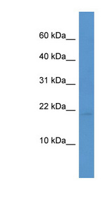 HSPB7 / CvHSP Antibody - HSPB7 / CvHSP antibody Western blot of Mouse Heart lysate. This image was taken for the unconjugated form of this product. Other forms have not been tested.