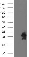 HSPB7 / CvHSP Antibody - HEK293T cells were transfected with the pCMV6-ENTRY control (Left lane) or pCMV6-ENTRY HSPB7 (Right lane) cDNA for 48 hrs and lysed. Equivalent amounts of cell lysates (5 ug per lane) were separated by SDS-PAGE and immunoblotted with anti-HSPB7.