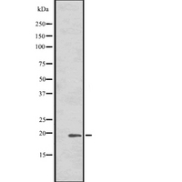 HSPB7 / CvHSP Antibody - Western blot analysis of HSPB7 expression in human fetal heart cells lysate. The lane on the left is treated with the antigen-specific peptide.