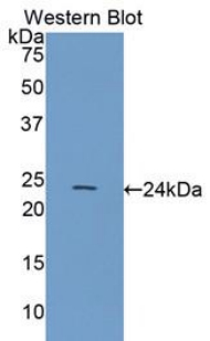 HSPB8 / H11 / HSP22 Antibody - Western blot of recombinant HSPB8 / H11 / HSP22.  This image was taken for the unconjugated form of this product. Other forms have not been tested.