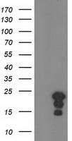 HSPB8 / H11 / HSP22 Antibody - HEK293T cells were transfected with the pCMV6-ENTRY control (Left lane) or pCMV6-ENTRY HSPB8 (Right lane) cDNA for 48 hrs and lysed. Equivalent amounts of cell lysates (5 ug per lane) were separated by SDS-PAGE and immunoblotted with anti-HSPB8.