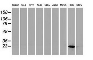 HSPB8 / H11 / HSP22 Antibody - Western blot of extracts (35ug) from 9 different cell lines by using anti-HSPB8 monoclonal antibody.