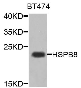 HSPB8 / H11 / HSP22 Antibody - Western blot analysis of extracts of BT474 cells.