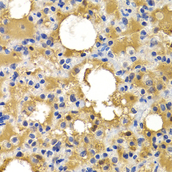 HSPB8 / H11 / HSP22 Antibody - Immunohistochemistry of paraffin-embedded rat lung tissue.