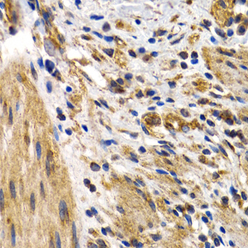 HSPB8 / H11 / HSP22 Antibody - Immunohistochemistry of paraffin-embedded human normal colon tissue.