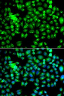 HSPB8 / H11 / HSP22 Antibody - Immunofluorescence analysis of HeLa cells.