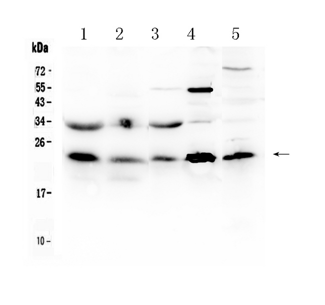 HSPB8 / H11 / HSP22 Antibody - Western blot - Anti-HSPB8/Hsp22 Picoband Antibody