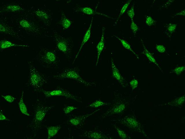 HSPB8 / H11 / HSP22 Antibody - Immunofluorescence staining of HSPB8 in HeLa cells. Cells were fixed with 4% PFA, permeabilzed with 0.1% Triton X-100 in PBS, blocked with 10% serum, and incubated with rabbit anti-human HSPB8 polyclonal antibody (dilution ratio 1:1000) at 4°C overnight. Then cells were stained with the Alexa Fluor 488-conjugated Goat Anti-rabbit IgG secondary antibody (green). Positive staining was localized to nucleus and cytoplasm.