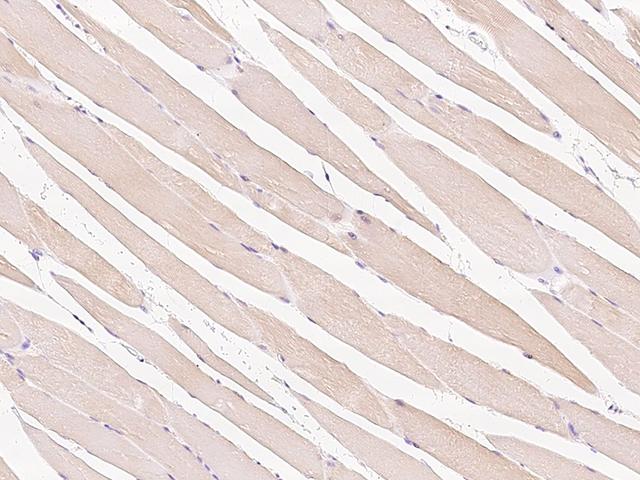 HSPB8 / H11 / HSP22 Antibody - Immunochemical staining HSPB8 in human skeletal muscle with rabbit polyclonal antibody at 1:200 dilution, formalin-fixed paraffin embedded sections.