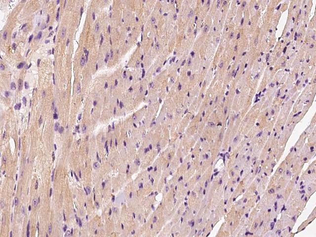 HSPB8 / H11 / HSP22 Antibody - Immunochemical staining HSPB8 in mouse heart with rabbit polyclonal antibody at 1:200 dilution, formalin-fixed paraffin embedded sections.