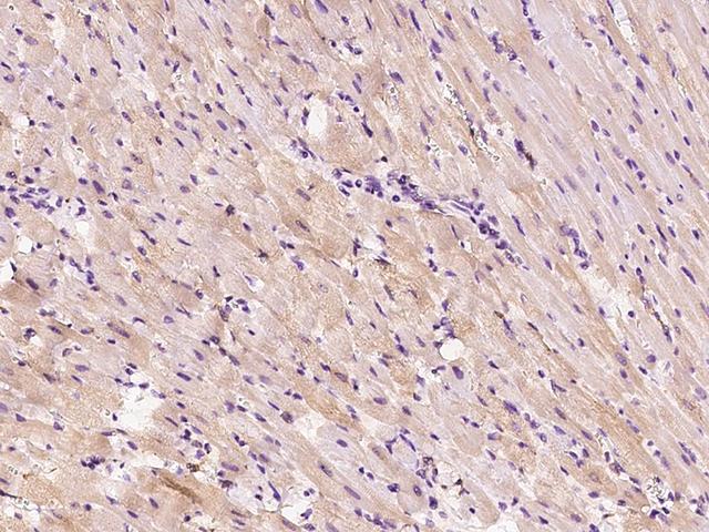 HSPB8 / H11 / HSP22 Antibody - Immunochemical staining HSPB8 in rat heart with rabbit polyclonal antibody at 1:200 dilution, formalin-fixed paraffin embedded sections.