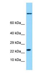 HSPB9 Antibody - HSPB9 antibody Western Blot of Fetal Lung.  This image was taken for the unconjugated form of this product. Other forms have not been tested.