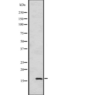 HSPB9 Antibody - Western blot analysis of HSPB9 expression in A549 cells line lysates. The lane on the left is treated with the antigen-specific peptide.