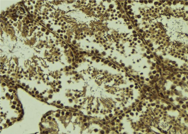 HSPB9 Antibody - 1:100 staining mouse testis tissue by IHC-P. The sample was formaldehyde fixed and a heat mediated antigen retrieval step in citrate buffer was performed. The sample was then blocked and incubated with the antibody for 1.5 hours at 22°C. An HRP conjugated goat anti-rabbit antibody was used as the secondary.