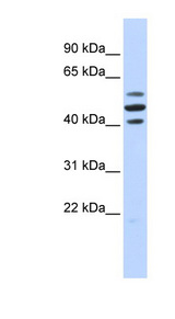 HSPBAP1 Antibody - HSPBAP1 antibody Western blot of Fetal Brain lysate. This image was taken for the unconjugated form of this product. Other forms have not been tested.