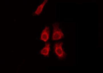 HSPBAP1 Antibody - Staining HeLa cells by IF/ICC. The samples were fixed with PFA and permeabilized in 0.1% Triton X-100, then blocked in 10% serum for 45 min at 25°C. The primary antibody was diluted at 1:200 and incubated with the sample for 1 hour at 37°C. An Alexa Fluor 594 conjugated goat anti-rabbit IgG (H+L) Ab, diluted at 1/600, was used as the secondary antibody.
