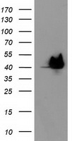HSPBP1 Antibody - HEK293T cells were transfected with the pCMV6-ENTRY control (Left lane) or pCMV6-ENTRY HSPBP1 (Right lane) cDNA for 48 hrs and lysed. Equivalent amounts of cell lysates (5 ug per lane) were separated by SDS-PAGE and immunoblotted with anti-HSPBP1.