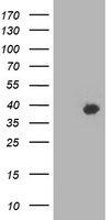 HSPBP1 Antibody - HEK293T cells were transfected with the pCMV6-ENTRY control (Left lane) or pCMV6-ENTRY HSPBP1 (Right lane) cDNA for 48 hrs and lysed. Equivalent amounts of cell lysates (5 ug per lane) were separated by SDS-PAGE and immunoblotted with anti-HSPBP1.