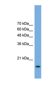 HSPC004 / POP5 Antibody - POP5 antibody Western blot of Transfected 293T cell lysate. This image was taken for the unconjugated form of this product. Other forms have not been tested.