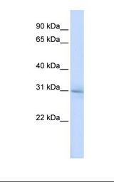 HSPC133 / METTL5 Antibody - HepG2 cell lysate. Antibody concentration: 1.0 ug/ml. Gel concentration: 12%.  This image was taken for the unconjugated form of this product. Other forms have not been tested.