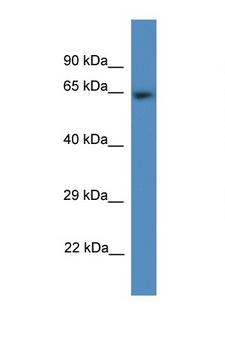 HSPC167 / CDK5RAP1 Antibody - CDK5RAP1 antibody Western blot of Rat Heart lysate. Antibody concentration 1 ug/ml. This image was taken for the unconjugated form of this product. Other forms have not been tested.